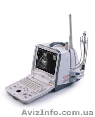 Аппарат Узи Mindray - <ro>Изображение</ro><ru>Изображение</ru> #1, <ru>Объявление</ru> #424920