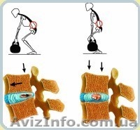 90% грыж, остеохондроз, сколеоз - лечится профилактором Евминова - <ro>Изображение</ro><ru>Изображение</ru> #3, <ru>Объявление</ru> #856861