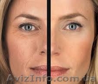 RF радиоволновой лифтинг, аппаратное омоложение, RF липолиз - <ro>Изображение</ro><ru>Изображение</ru> #2, <ru>Объявление</ru> #1007157