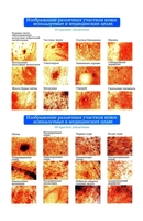 Анализатор состояния кожного покрова тела HEALTHY JOY. WK -01. Цена скидка -75%! - <ro>Изображение</ro><ru>Изображение</ru> #3, <ru>Объявление</ru> #1498229