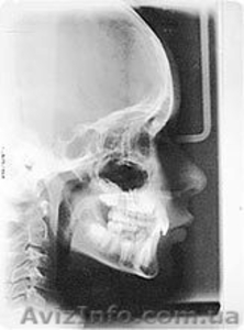 Панорамный рентгеновский аппарат PM 2002 CC Proline c цефалостатной приставкой P - <ro>Изображение</ro><ru>Изображение</ru> #7, <ru>Объявление</ru> #621589