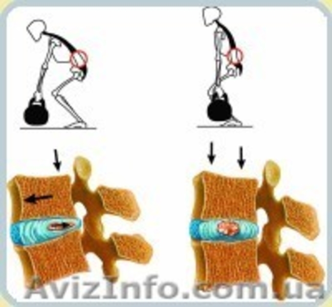 90% грыж, остеохондроз, сколеоз - лечится профилактором Евминова - <ro>Изображение</ro><ru>Изображение</ru> #3, <ru>Объявление</ru> #856861