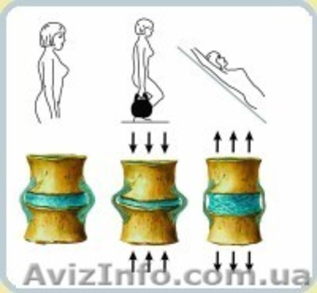 90% грыж, остеохондроз, сколеоз - лечится профилактором Евминова - <ro>Изображение</ro><ru>Изображение</ru> #4, <ru>Объявление</ru> #856861