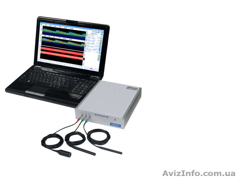 Кардиограф, допплер, энцефалограф, миограф, реограф Луганск - <ro>Изображение</ro><ru>Изображение</ru> #4, <ru>Объявление</ru> #1048477