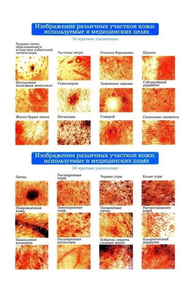 Анализатор состояния кожного покрова тела HEALTHY JOY. WK -01. Цена скидка -75%! - <ro>Изображение</ro><ru>Изображение</ru> #3, <ru>Объявление</ru> #1498229